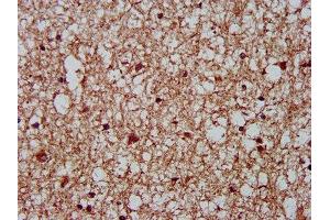IHC image of ABIN7149368 diluted at 1:400 and staining in paraffin-embedded human brain tissue performed on a Leica BondTM system. (CKAP5 antibody  (AA 1802-2019))