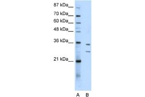 WB Suggested Anti-BXDC5 Antibody Titration:  0.