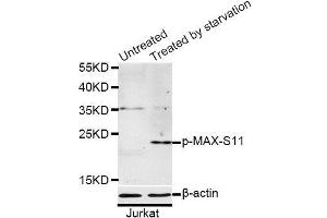Western blot analysis of extracts of Jurkat cells, using Phospho-MAX-S11 antibody (ABIN5969917) at 1/1000 dilution. (MAX antibody  (pSer11))