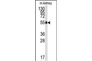 Western blot analysis of anti-ALDH9A1 Antibody in mouse kidney tissue lysates (35ug/lane).