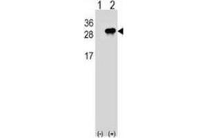 Western blot analysis of Interleukin-28B (arrow) using rabbit polyclonal Interleukin-28B  (N-term): 293 cell lysates (2ug/lane) either nontransfected (Lane 1) or transiently transfected (Lane 2) with the IL28B gene.