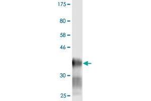 Western Blot detection against Immunogen (38. (LY6H antibody  (AA 26-140))