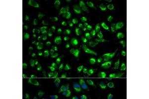 Immunofluorescence analysis of HeLa cells using SPAM1 Polyclonal Antibody (SPAM1 antibody)
