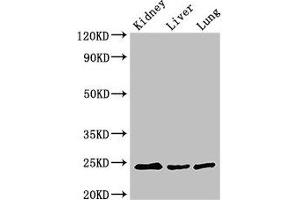 Western Blot Positive WB detected in: Mouse kidney tissue, Mouse liver tissue, Rat lung tissue All lanes: RAB5A antibody at 3 μg/mL Secondary Goat polyclonal to rabbit IgG at 1/50000 dilution Predicted band size: 24, 23 kDa Observed band size: 24 kDa (RAB5 antibody  (AA 1-215))