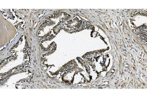 IHC analysis of GRSF1 using anti-GRSF1 antibody (ABIN7599803). (GRSF1 antibody  (AA 119-405))