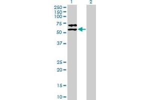 Western Blot analysis of SERPINF2 expression in transfected 293T cell line by SERPINF2 MaxPab polyclonal antibody. (alpha 2 Antiplasmin antibody  (AA 1-491))