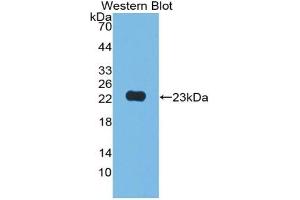 Detection of Recombinant JAM2, Human using Polyclonal Antibody to Junctional Adhesion Molecule 2 (JAM2) (JAM2 antibody  (AA 74-250))