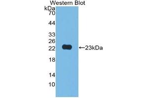 Detection of Recombinant JAM2, Human using Polyclonal Antibody to Junctional Adhesion Molecule 2 (JAM2) (JAM2 antibody  (AA 74-250))