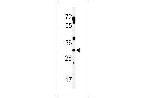 Western blot analysis of lysate from human heart tissue lysate, using TBCD7 Antibody (Center) (ABIN653858 and ABIN2843117). (TBC1D7 antibody  (AA 150-179))