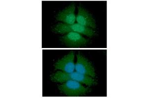 ICC/IF analysis of UGDH in HeLa cells line, stained with DAPI (Blue) for nucleus staining and monoclonal anti-human UGDH antibody (1:100) with goat anti-mouse IgG-Alexa fluor 488 conjugate (Green). (UGDH antibody)