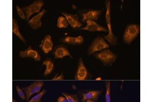 Immunofluorescence analysis of U-2 OS cells using EIF5B Polyclonal Antibody at dilution of 1:100. (EIF5B antibody)