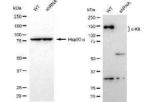 Western blotting analysis using c-Kit antibody (ABIN7799335).