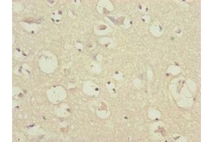 Immunohistochemistry of paraffin-embedded human brain tissue using ABIN7147410 at dilution of 1:100 (CEP57 antibody  (AA 1-240))