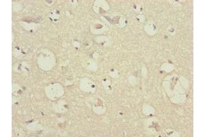Immunohistochemistry of paraffin-embedded human brain tissue using ABIN7147410 at dilution of 1:100 (CEP57 antibody  (AA 1-240))