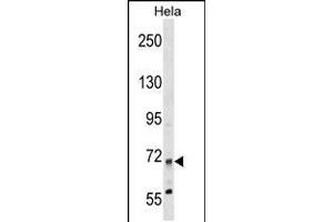 Western blot analysis in Hela cell line lysates (35ug/lane). (MTMR14 antibody  (N-Term))