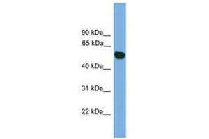 Image no. 1 for anti-Epoxide Hydrolase 1, Microsomal (Xenobiotic) (EPHX1) (AA 35-84) antibody (ABIN6745051) (EPHX1 antibody  (AA 35-84))