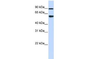 WB Suggested Anti-ADHFE1 Antibody Titration: 0. (ADHFE1 antibody  (Middle Region))