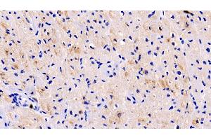 Detection of LOXL1 in Human Cardiac Muscle Tissue using Monoclonal Antibody to Lysyl Oxidase Like Protein 1 (LOXL1) (LOXL1 antibody  (AA 369-574))