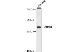 Western blot analysis of extracts of rat lung, using GLIPR1 antibody (ABIN7267387) at 1:1000 dilution. (GLIPR1 antibody  (AA 22-140))