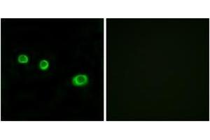 Immunofluorescence analysis of MCF7 cells, using GBP1 Antibody. (GBP1 antibody  (AA 71-120))