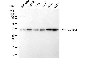 Western blotting analysis using CAPZA1 antibody (ABIN7797863).