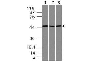 Image no. 1 for anti-SRY (Sex Determining Region Y)-Box 11 (SOX11) (AA 23-236) antibody (ABIN5027536) (SOX11 antibody  (AA 23-236))