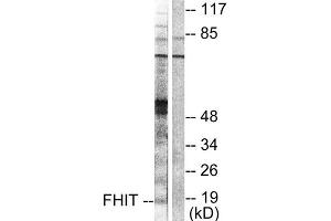 Western Blotting (WB) image for anti-Fragile Histidine Triad (FHIT) (Internal Region) antibody (ABIN1848544) (FHIT antibody  (Internal Region))