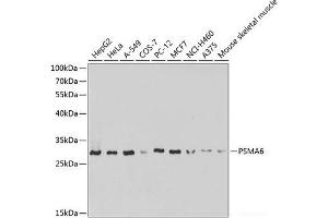 Western blot analysis of extracts of various cell lines using PSMA6 Polyclonal Antibody at dilution of 1:1000. (PSMA6 antibody)
