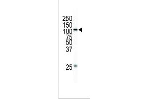 Western blot analysis of anti-MEKK1 Pab (ABIN392403 and ABIN2842022) in HL-60 cell lysate. (MAP3K1 antibody  (C-Term))