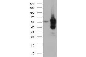 HEK293T cells were transfected with the pCMV6-ENTRY control (Left lane) or pCMV6-ENTRY DYNC1LI1 (Right lane) cDNA for 48 hrs and lysed. (DYNC1LI1 antibody)