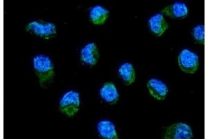 IF analysis of ND6/MT-ND6 using anti-ND6/MT-ND6 antibody (ABIN7599589).