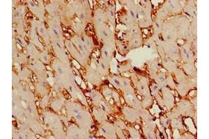 Immunohistochemistry (IHC) image for anti-TSR2, 20S rRNA Accumulation, Homolog (TSR2) (AA 1-191) antibody (ABIN7164202)