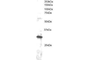 Image no. 1 for anti-Dickkopf Homolog 4 (Xenopus Laevis) (DKK4) (C-Term) antibody (ABIN374183) (DKK4 antibody  (C-Term))