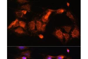 Immunofluorescence (IF) image for anti-Glycine Cleavage System H Protein (GCSH) antibody (ABIN7257311)
