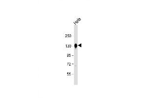 Western Blot at 1:8000 dilution + Hela whole cell lysate Lysates/proteins at 20 ug per lane. (Cadherin antibody  (C-Term))