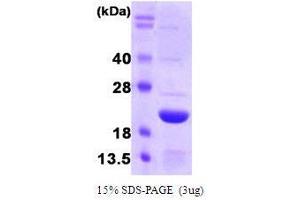Figure annotation denotes ug of protein loaded and % gel used. (FTL Protein (AA 1-175))