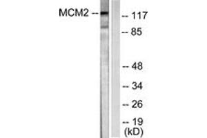 Western blot analysis of extracts from 293 cells, using MCM2 Antibody. (MCM2 antibody  (AA 1-50))