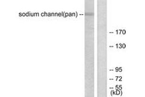 Western blot analysis of extracts from HuvEc cells, using Sodium Channel-pan Antibody. (Sodium Channel antibody  (AA 1466-1515))