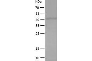 PAX6 Protein (AA 2-422) (His tag)