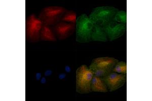 ABIN6257106 and ABIN6275018 staining  cells by IF/ICC. (CLDN8 antibody  (C-Term))