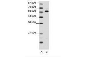 Image no. 1 for anti-Thyroid Hormone Receptor Interactor 4 (TRIP4) (AA 191-240) antibody (ABIN202787) (TRIP4 antibody  (AA 191-240))