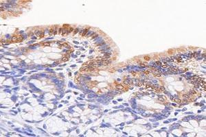 Immunohistochemistry analysis of paraffin-embedded rat colonitis using,FGF10 (ABIN7073940) at dilution of 1: 8000 (FGF10 antibody)