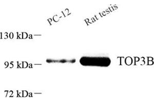 Western blot analysis of TOP3B (ABIN7075940) at dilution of 1: 800 (TOP3B antibody)