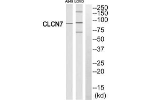 Western blot analysis of extracts from A549 cells and LOVO cells, using CLCN7 antibody. (CLCN7 antibody  (N-Term))