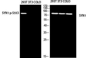 Western Blot (WB) analysis of 293T using SYN1 p-S553 antibody. (SYN1 antibody  (pSer553))