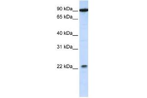 TMTC4 antibody used at 1 ug/ml to detect target protein.