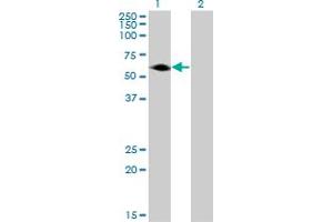 Western Blot analysis of AGER expression in transfected 293T cell line by AGER monoclonal antibody (M05), clone 1D1. (RAGE antibody  (AA 87-197))