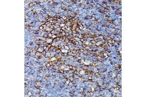 Immunohistochemistry (IHC) image for anti-Major Histocompatibility Complex, Class I, B (HLA-B) (AA 1-100) antibody (ABIN1513015)