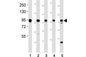 Western Blotting (WB) image for anti-Enhancer of Zeste Homolog 2 (EZH2) antibody (ABIN3028636)
