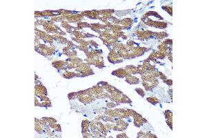 Immunohistochemistry of paraffin-embedded Rat heart using TIMMDC1 Rabbit pAb (ABIN7270929) at dilution of 1:100 (40x lens). (TIMMDC1 antibody  (AA 206-285))